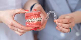 chuvstvitelnost-zubov-min1
