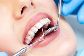 kostnaya-plastika-pri-implantacii-zubov-foto-1