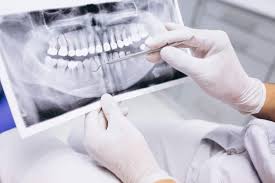 protezirovanie-zubov-poryadok-dejstvij