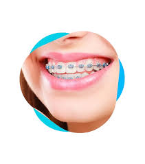 razryazhenie-kostnoj-tkani-zuba